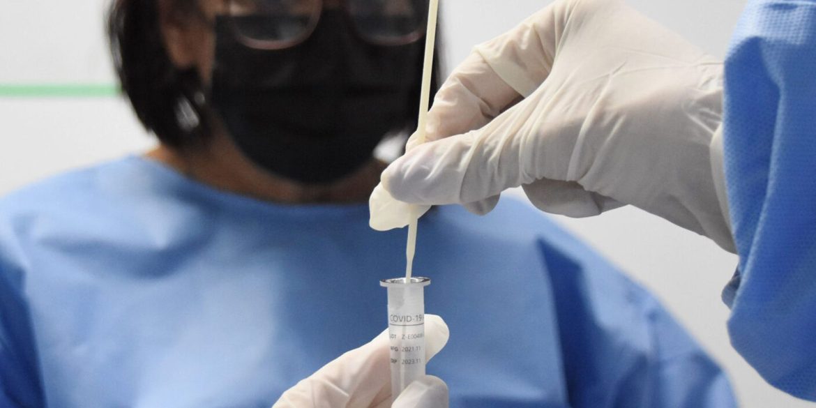 rj:-cenario-epidemiologico-de-covid-19-tem-tendencia-de-reducao rj:-cenario-epidemiologico-de-covid-19-tem-tendencia-de-reducao
